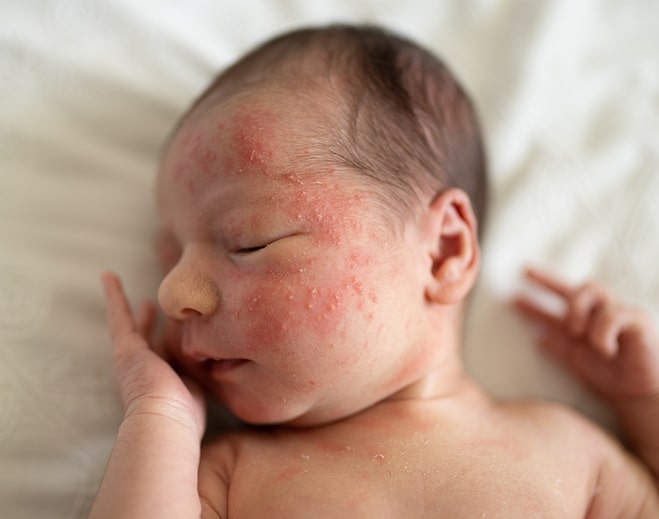 Newborn lying on blanket after bath