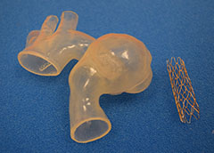 3D printed model of Ariana's aorta